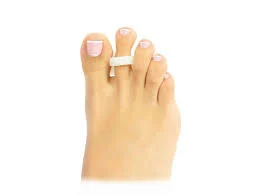 CASE REDRESSE D'ORTHELIS EN SILICONE